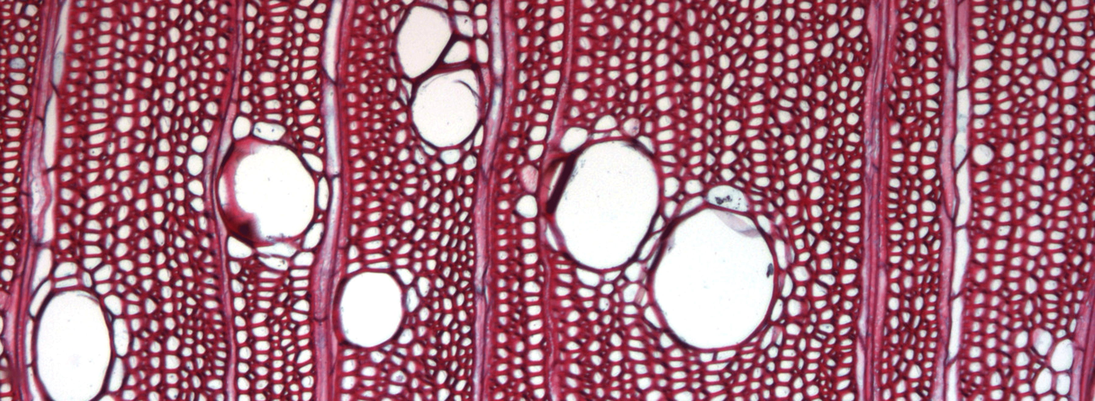 A microscopic  scan of Turraeanthus africana wood 
