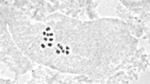 Chromosome picture.