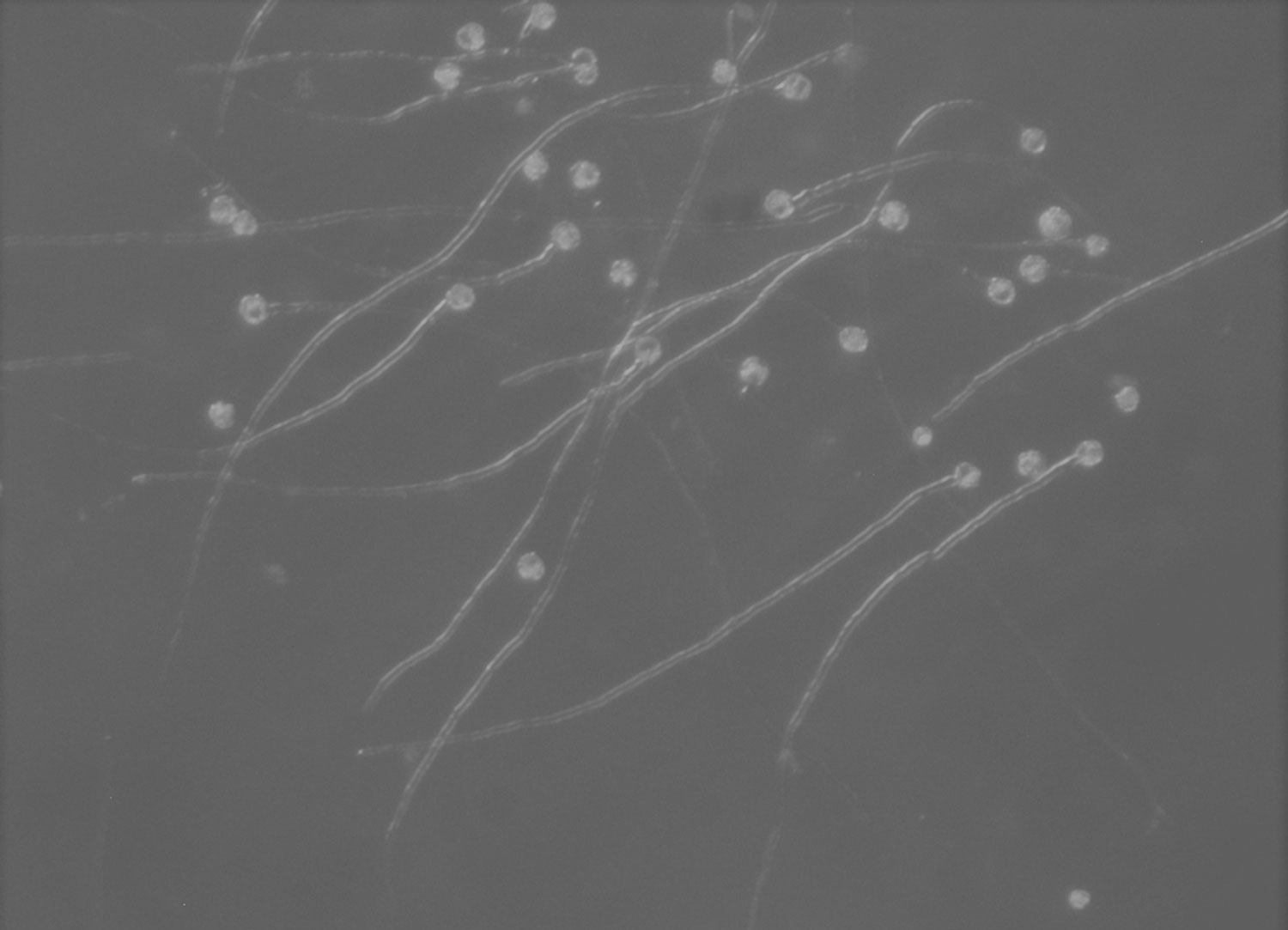 Microscopy image of pollen grains with tubes attached