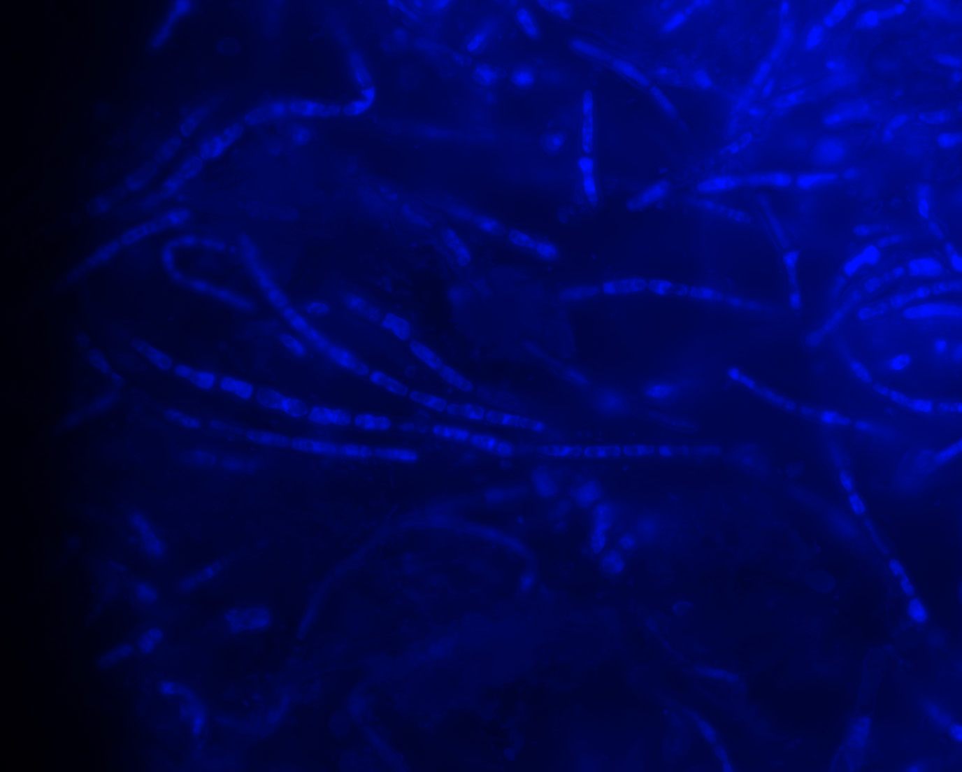 A microscope slide shows filaments of fungi glowing in an otherwise black image.